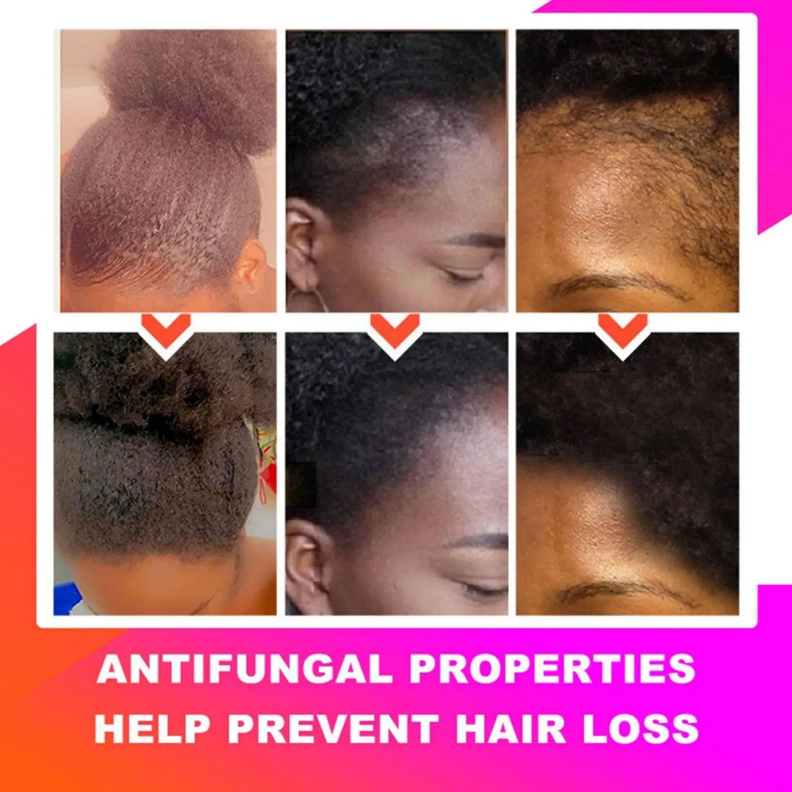 Anti Alopecia African Hair Growth Oil for Black Women Product Chebe Growth Spray Hair Hair Thicken Growth Moisturize Care Oil