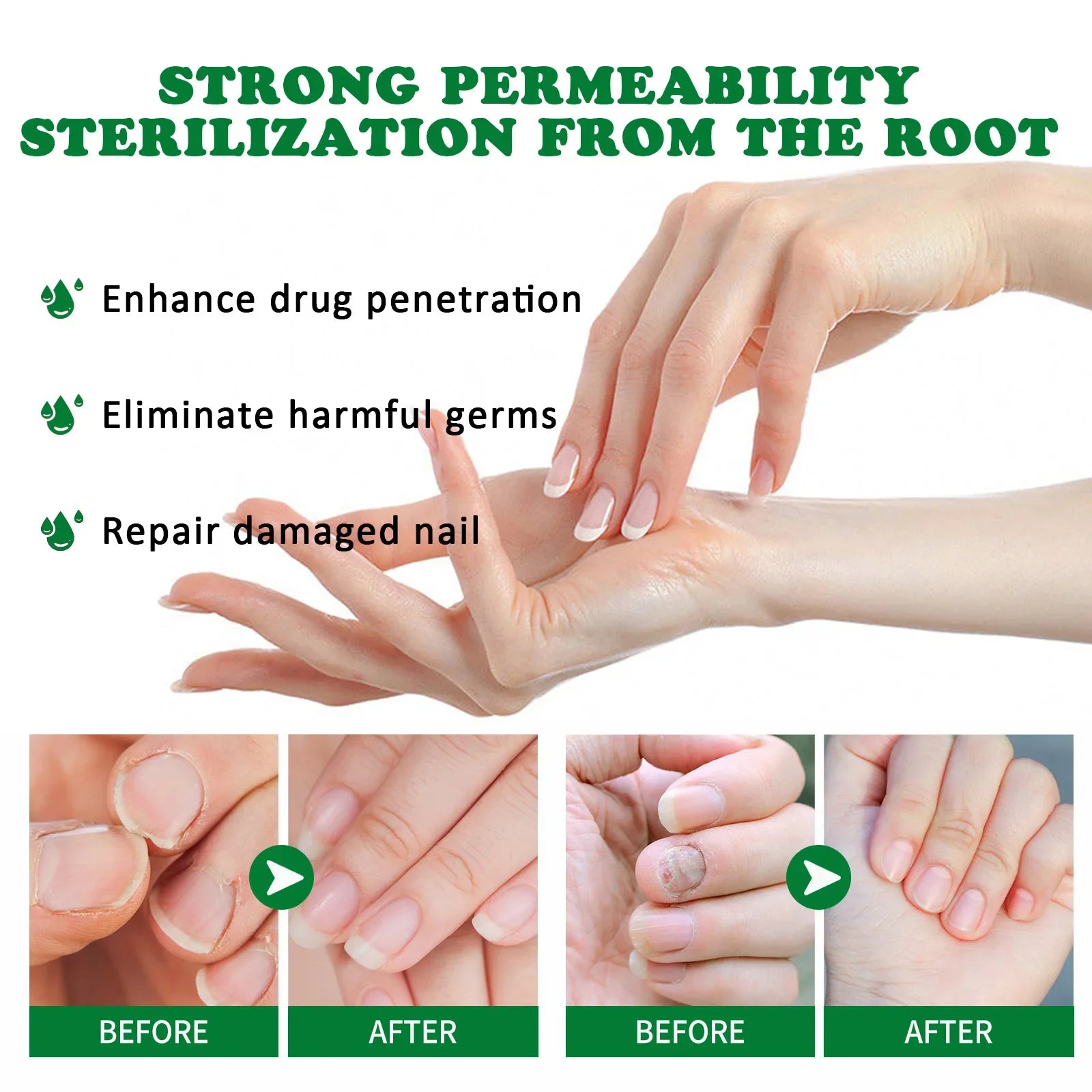 Nail Fungal Treatment Essential Oil Foot Toe Nail Fungus Removal Serum 7 Days Repair Onychomycosi Anti Infection Care Products