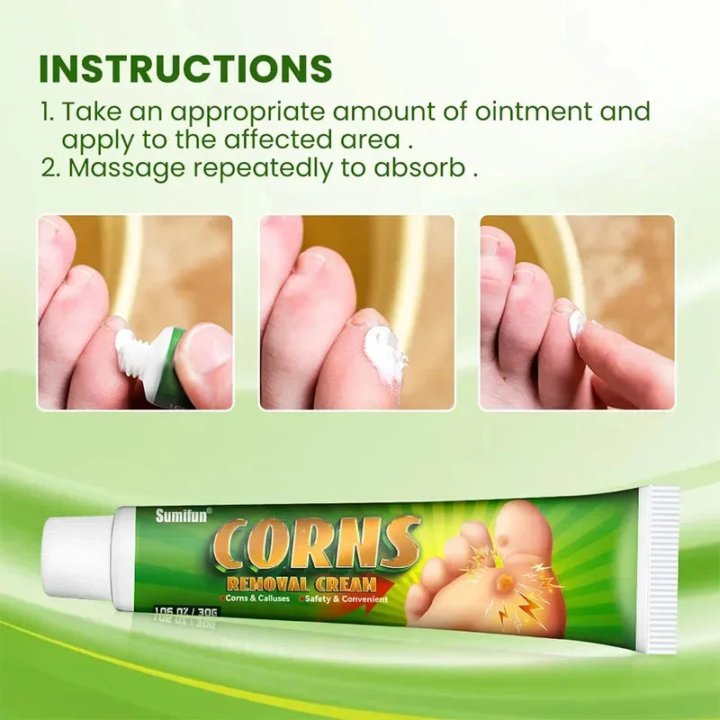 Foot Corn Remover Cream Chicken Eye Skin Infection Treatment Ointment Feet Dead Skin Calluses Removal Tool Health Care