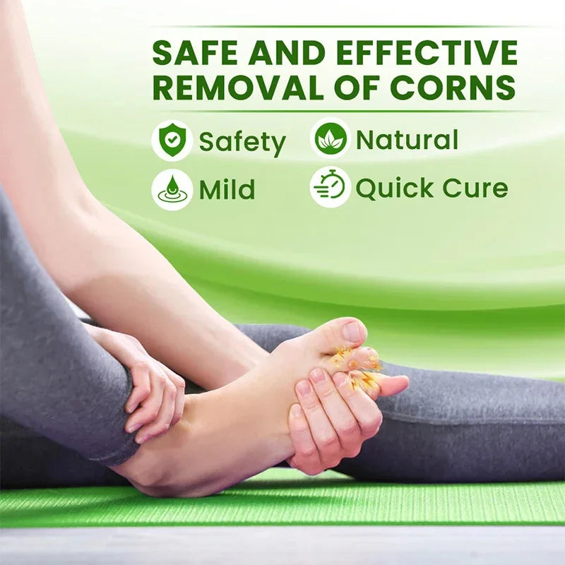 Foot Corn Remover Cream Chicken Eye Skin Infection Treatment Ointment Feet Dead Skin Calluses Removal Tool Health Care