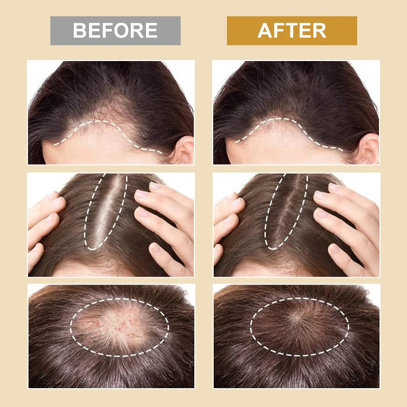 PURC Biotin Hair Growth Products for Men Women Hair Loss Treatment Fast Grow Hair Spray Regrowth Thicken Oil Hair Care