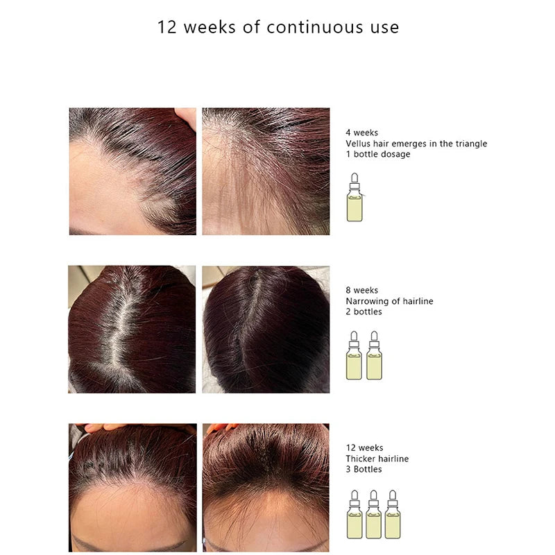 Hair Growth Serum 60ml Ordinary Original Authentic Hai Growth Essential Oils Care Essence Hair Loss Liquid Peptide Treatment